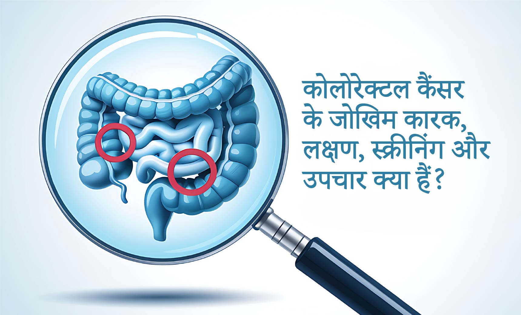कोलोरेक्टल कैंसर के जोखिम कारक, लक्षण, स्क्रीनिंग और उपचार क्या हैं? | Dr. Priya Tiwari