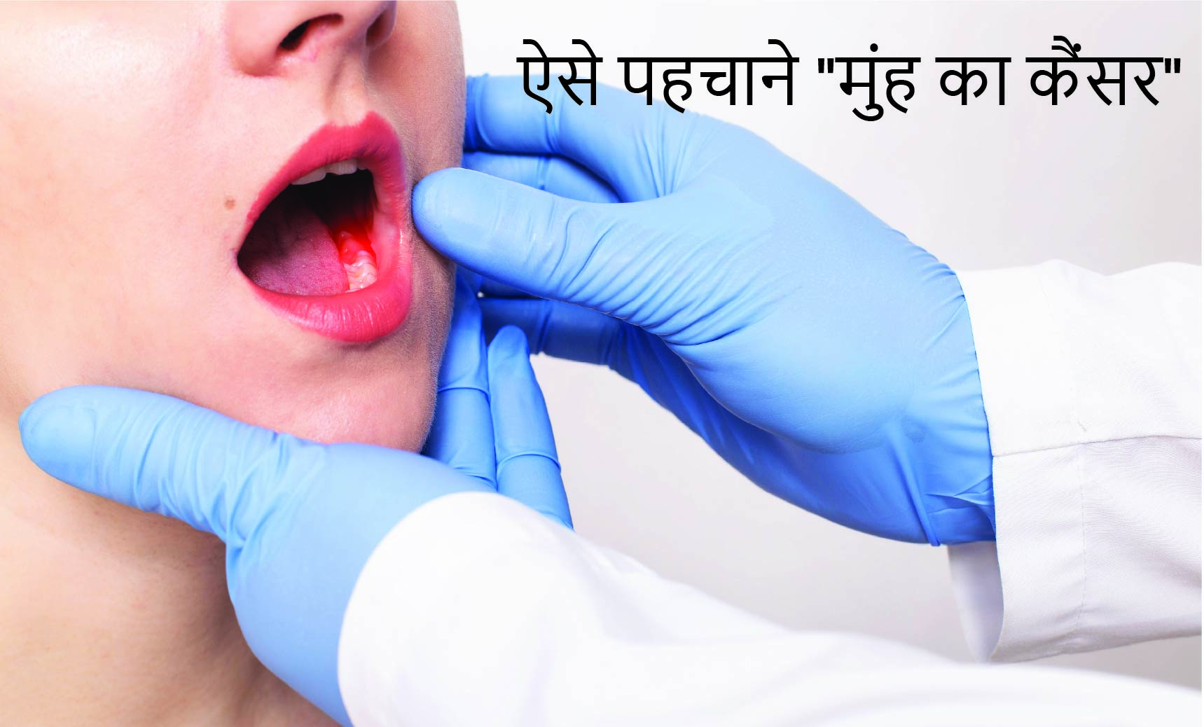 ऐसे पहचाने "मुंह का कैंसर" | Mouth-Cancer| Dr. Priya Tiwari