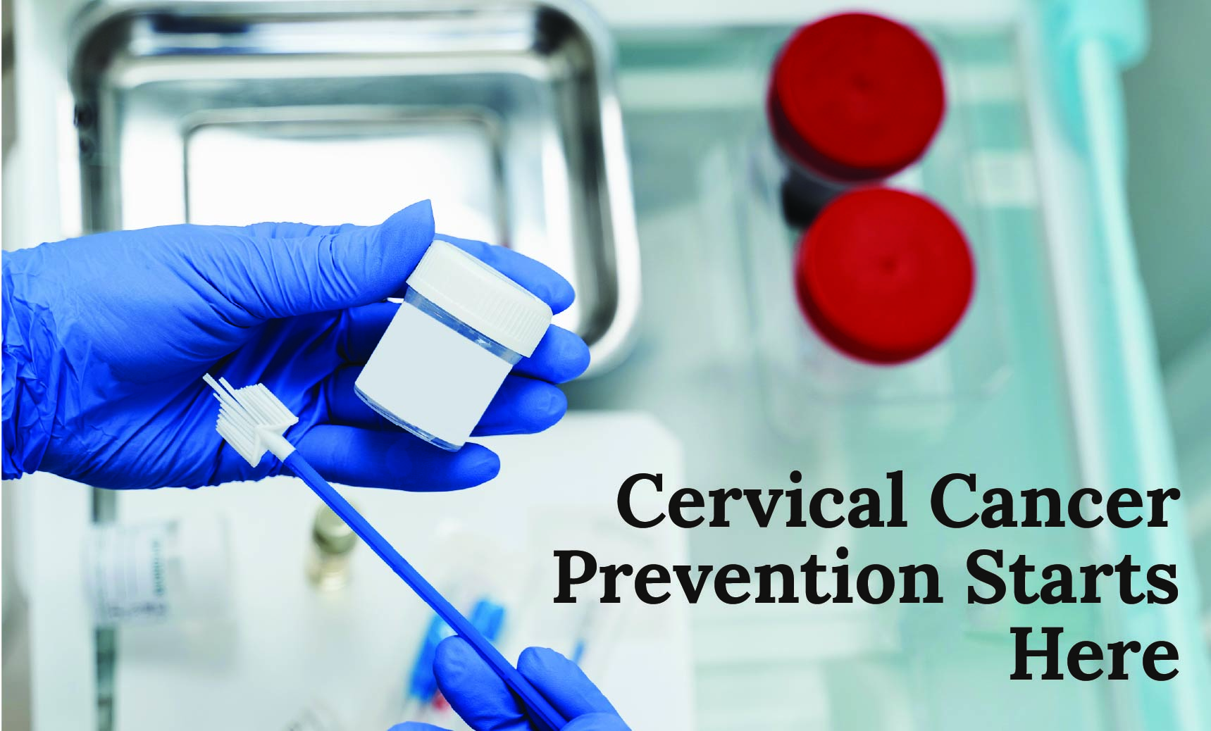 Cervical Cancer Prevention Starts Here