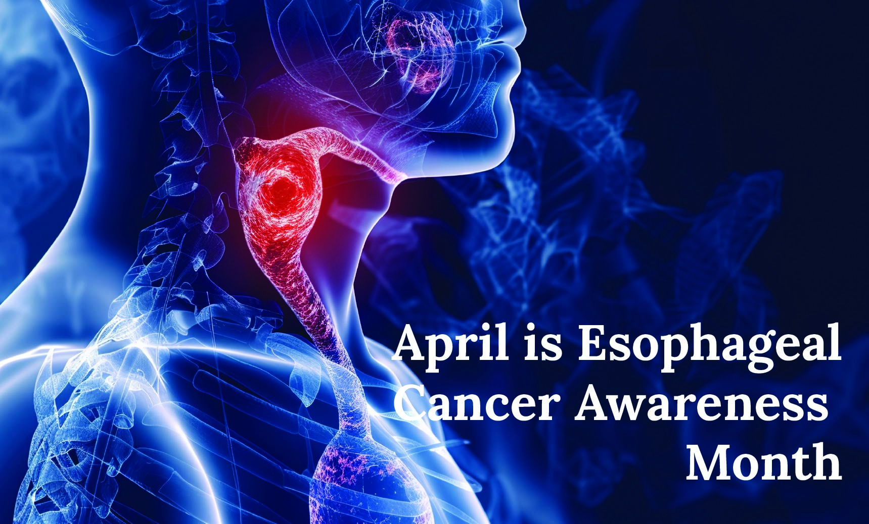 April is Esophageal Cancer Awareness Month | Dr. Priya Tiwari