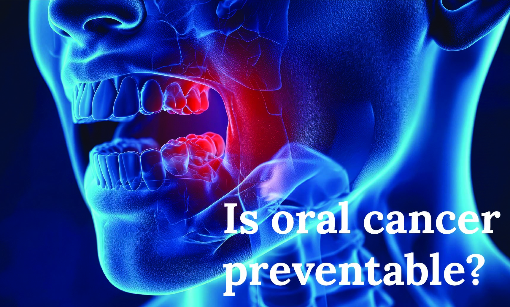 Is oral cancer preventable?