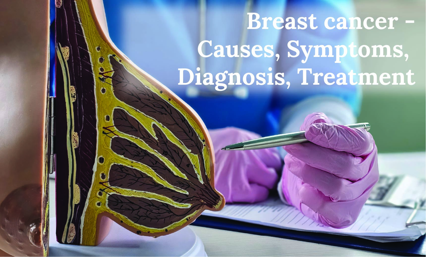 Breast cancer - Causes, Symptoms, Diagnosis, Treatment