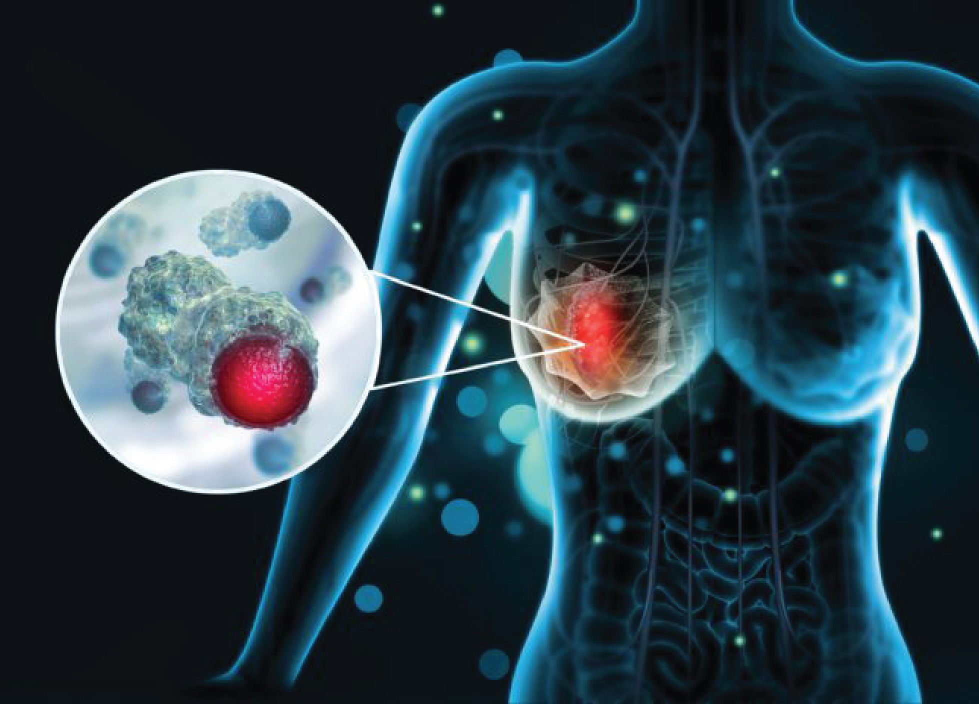 Breast Cancer Doctor In Delhi