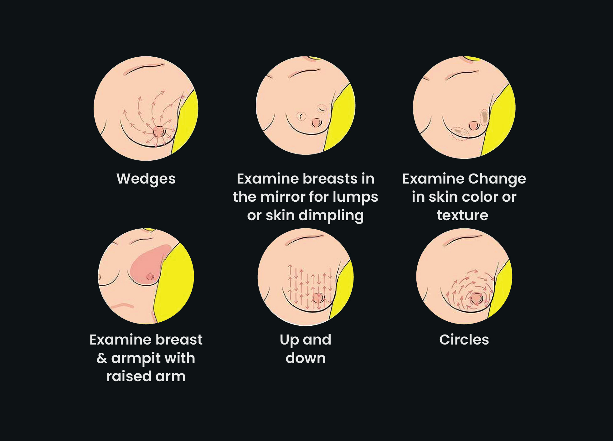 Symptoms-of-Lymphoma